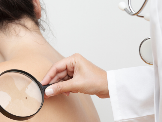 Skin Cancer Screening